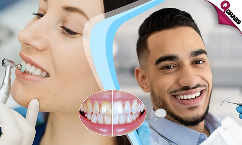 Dental Services: Teeth Whitening with Scaling & Polishing!